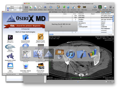 osirix md for mac free download